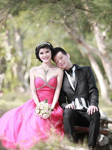 Cộng đồng mạng ngưỡng mộ cặp vợ chồng "đũa lệch"